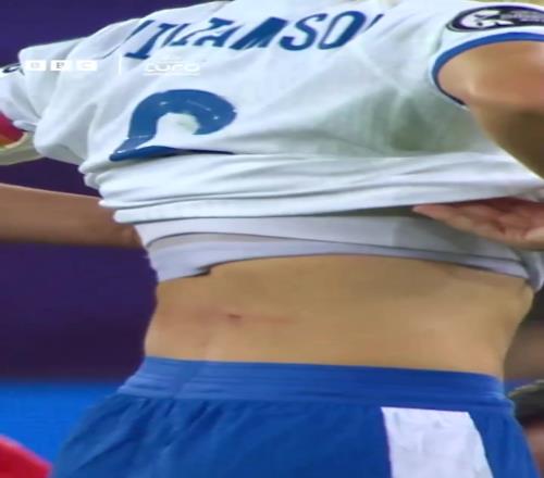 妹紙身上被鏟出血洞！BBC：這難道不是紅牌嗎