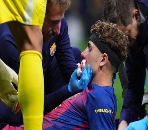 前裁判：不管穆索是否有意，踢費爾明那下就是點球