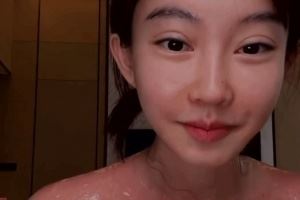 馮提莫戶外直播被嚴重曬傷！大方展示胸前大片紅腫