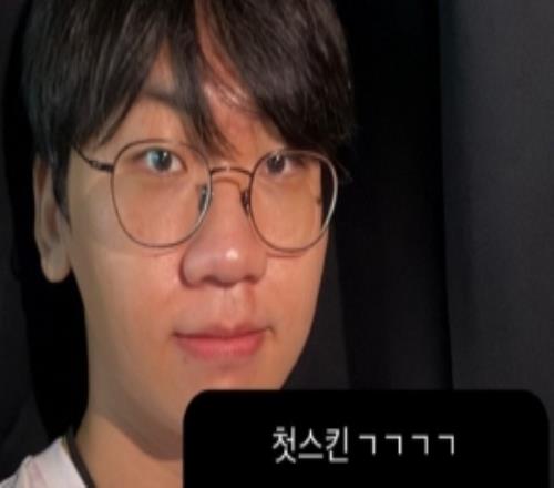 Doran更新動(dòng)態(tài)：皮膚選擇安蓓薩酒桶卡蜜爾其他