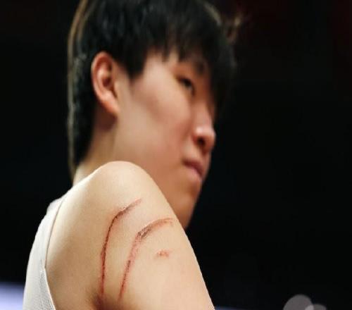 太拼了！杨瀚森与火箭内线肉搏缠斗，右臂出现两道大血印